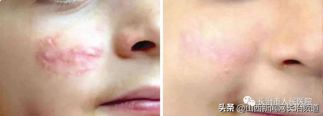 长治市人民医院整形科,长治市人民医院整形美容