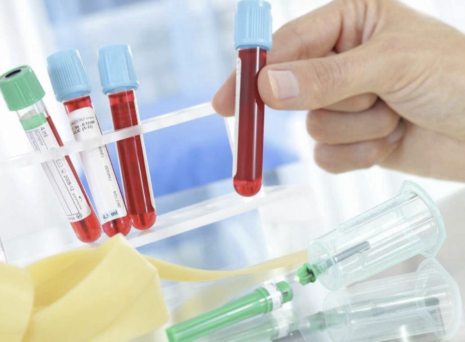 儿童骨密度检测中bmi正常范围,34岁骨密度检测说骨质疏松怎么办