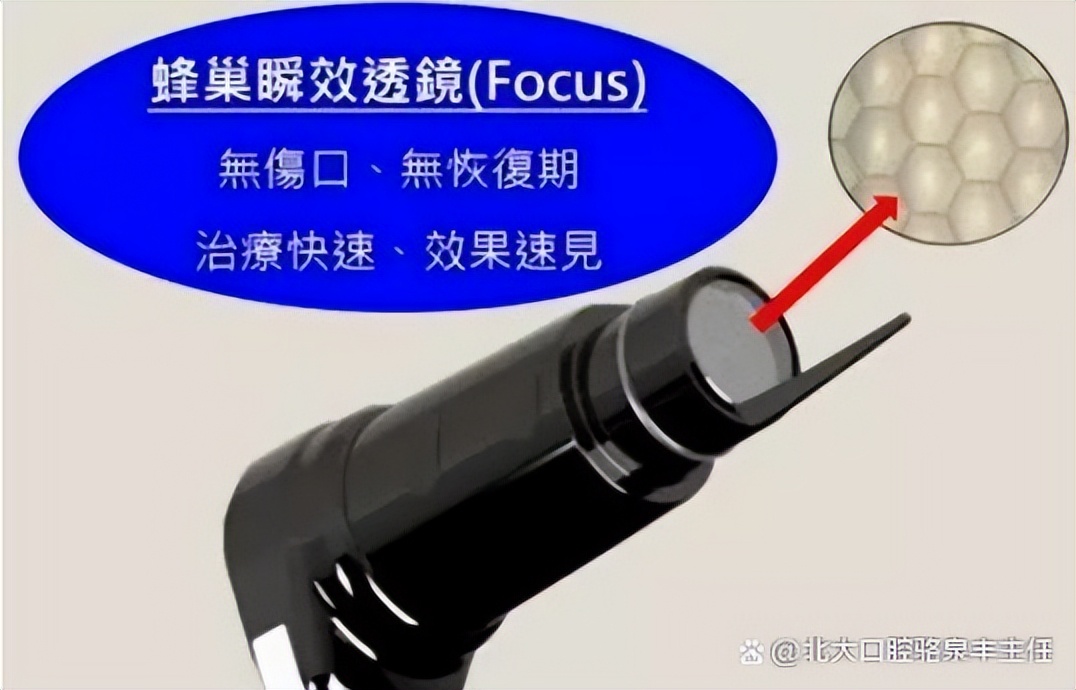 脉冲激光手术和超皮秒有什么区别,皮秒激光与传统激光有什么区别