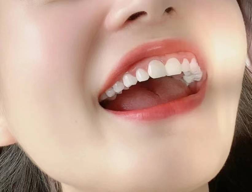 口腔喷雾杀菌除口臭持久留香测评,口臭哪个牌子的口腔喷雾好用