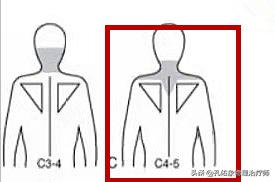 肩膀肌肉紧绷怎么放松,肩膀僵硬不放松怎么办