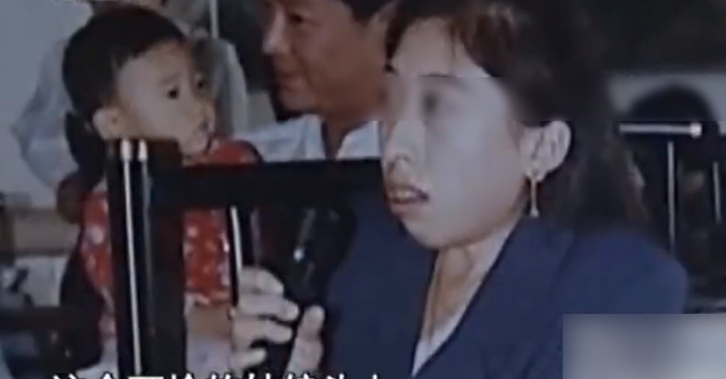 故事：大连39岁姑娘患怪病，皮肤坚硬宛如石膏，专家结论希望渺茫