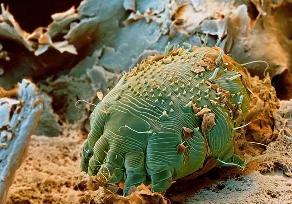 千万要注意六种寄生虫多的食物,提醒6种食物是寄生虫的重灾区