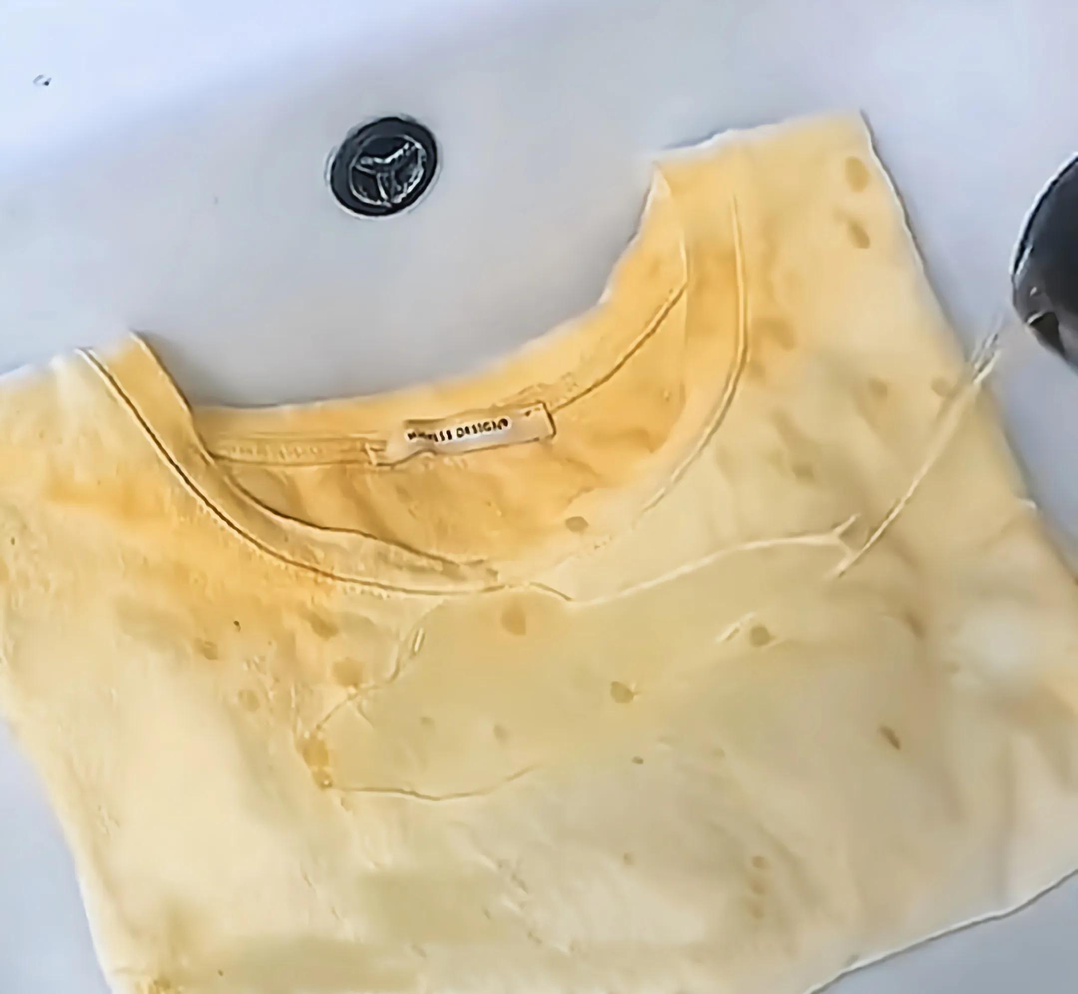 生活小妙招大全衣领上的油怎么洗,衣领发黄最有效的去除妙招