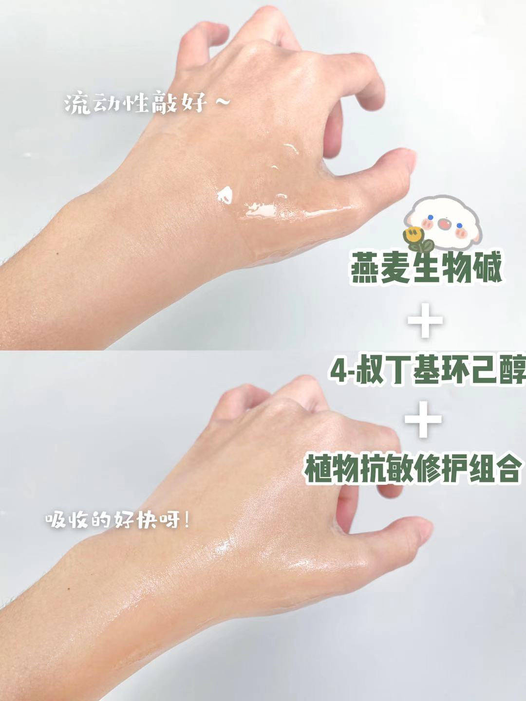 脸上长痘痘，如何正确的祛痘？