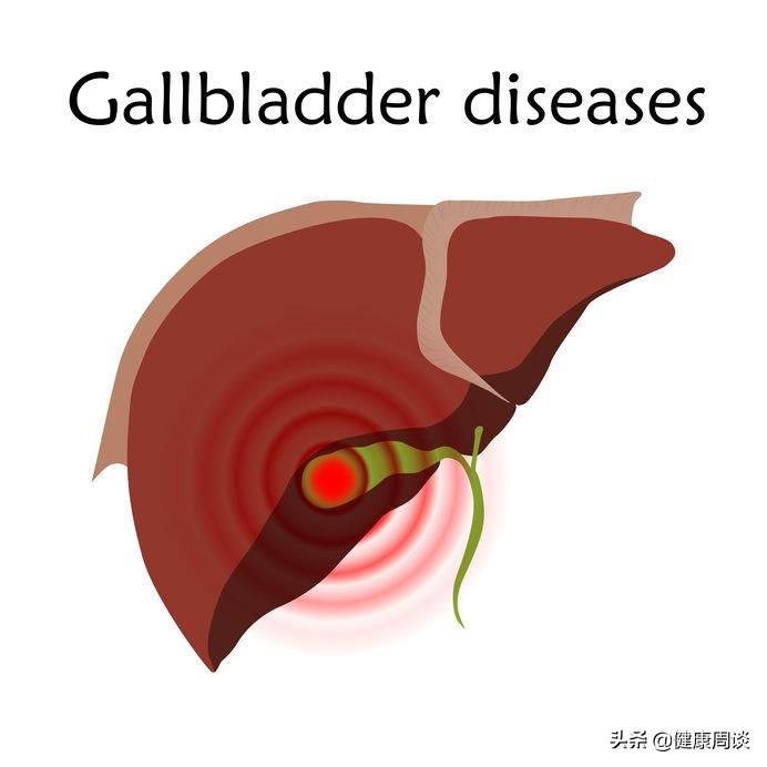 熬夜上火嘴里苦嘴臭怎么办,身体老上火怎么回事嘴还苦