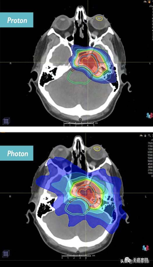 5年生存率超过90%是不是治疗率高,5年生存率图