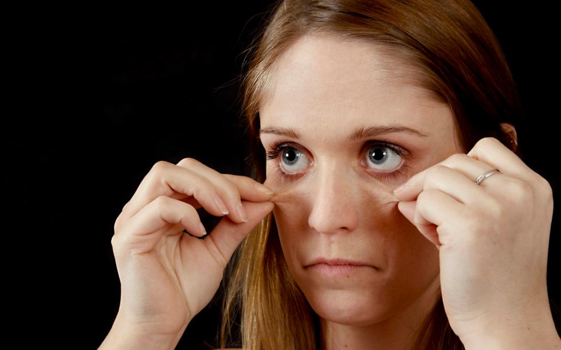 长黑眼圈是身体哪里出问题了吗,长黑眼圈和斑是什么原因