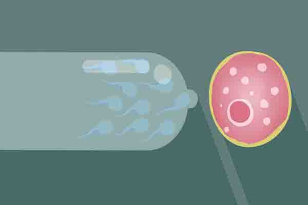 女性避孕用的环需要取吗,最佳避孕环对女性的危害