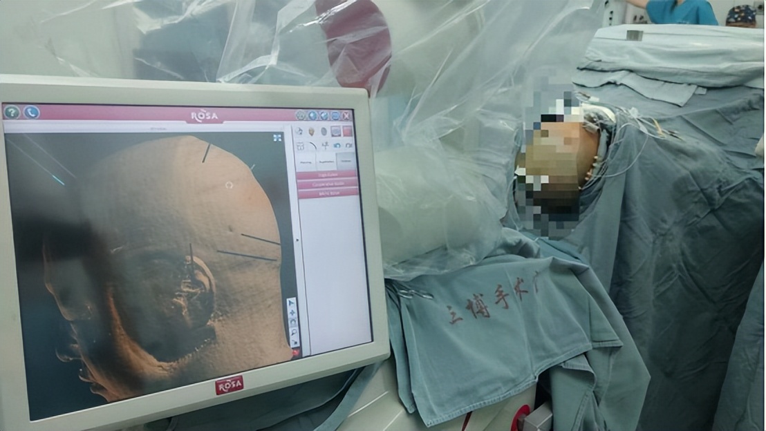 国家癫痫中心,全国二级癫痫中心名单