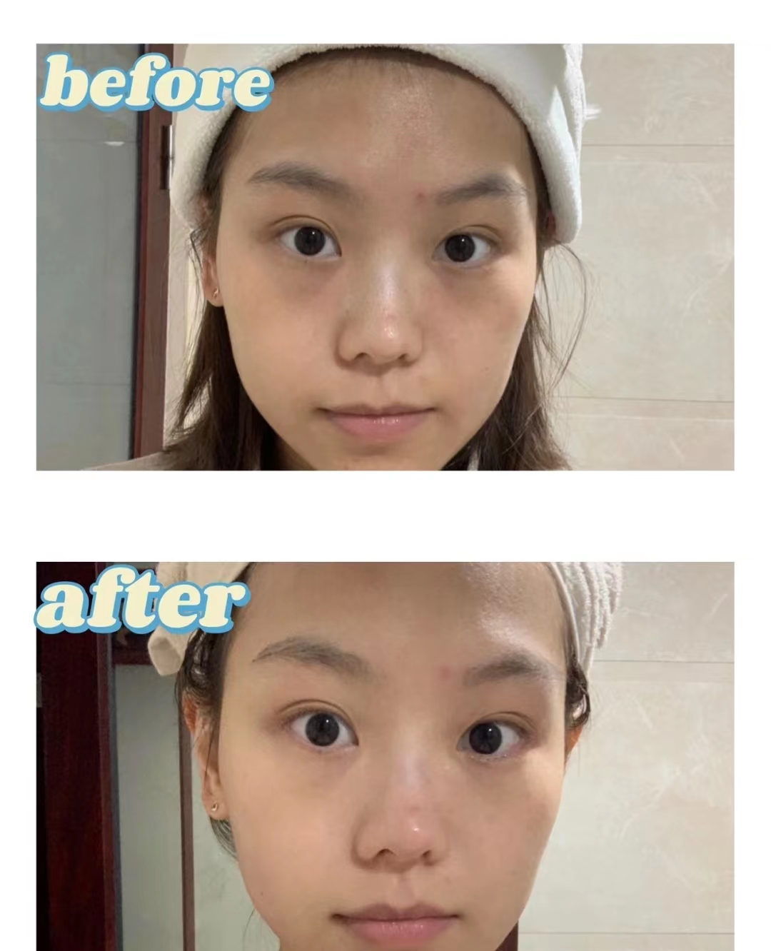 十大公认最好用的面膜品牌,最火的面膜lv