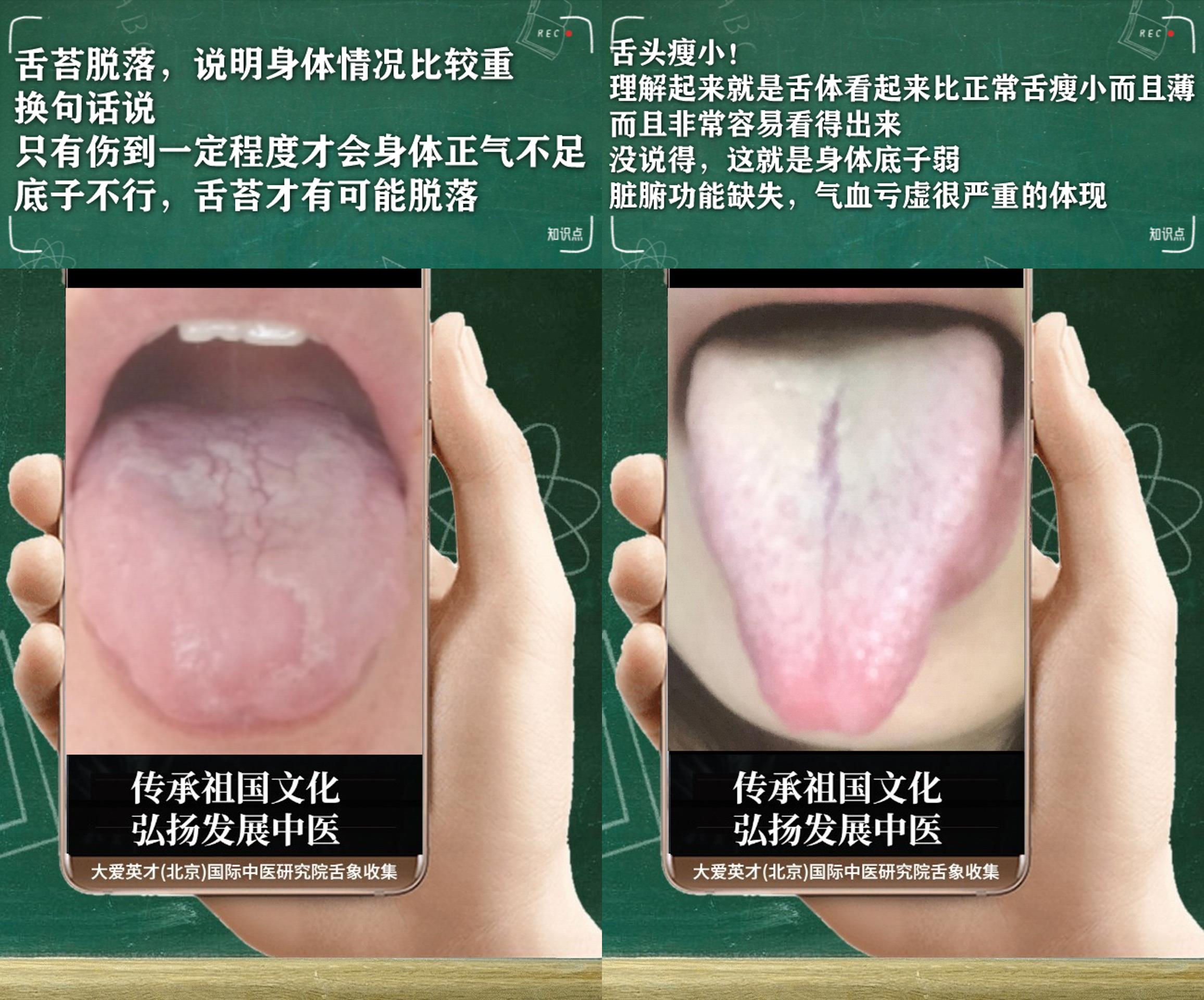 腰膝酸软中医辨证论治,中医腰膝酸软