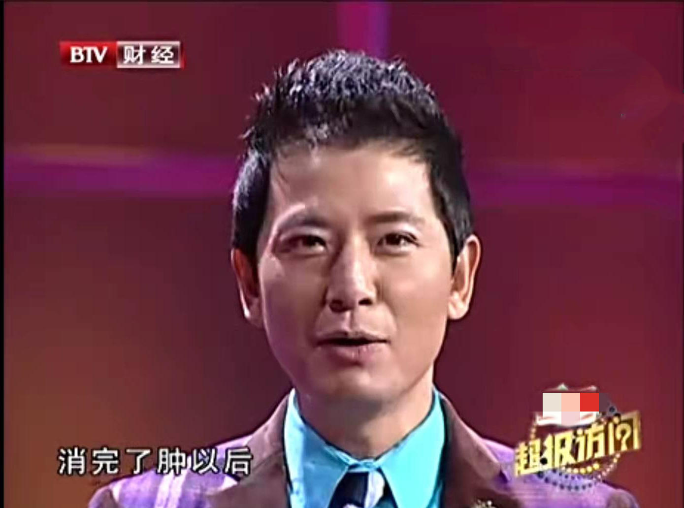 周星驰割双眼皮访谈,周星驰割双眼皮前的电影