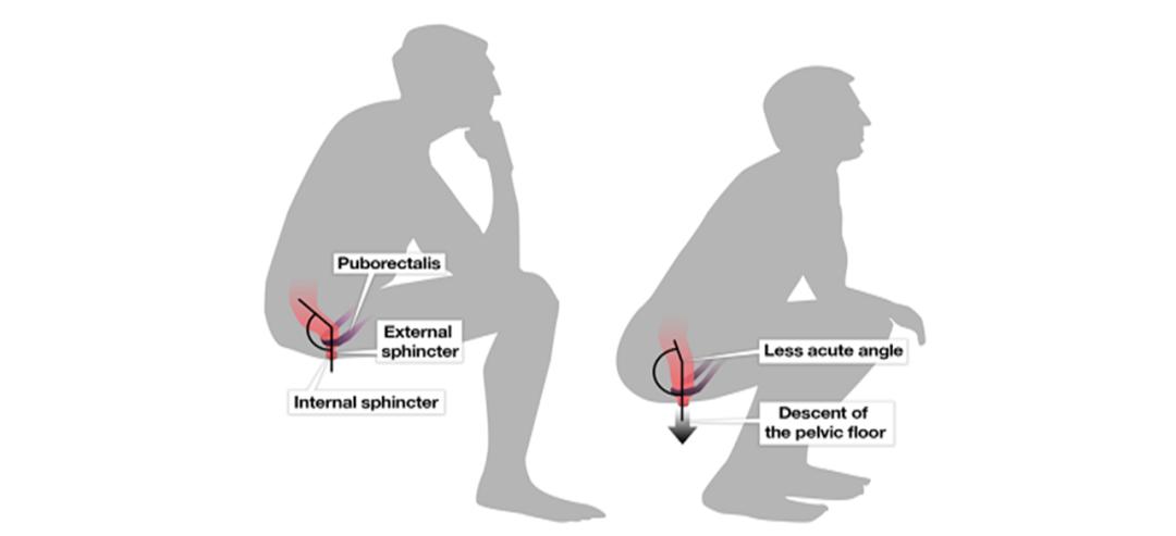 先别冲！原来你是这样的——“便便”