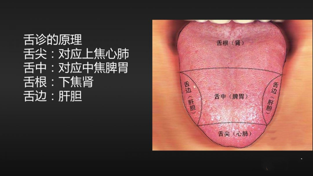 舌诊辨证和精准用药,中医诊病无需诊脉和观舌象靠谱不