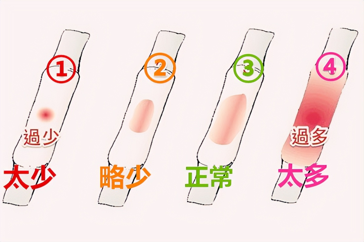 有这些症状女性一定要及时做检查,女性出现这些症状小心卵巢健康