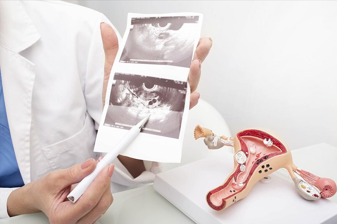 无痛人流真的不痛嘛,无痛人流后不出血也不痛正常吗