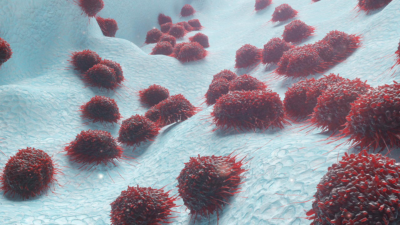 子宫内膜增厚乳房胀痛,子宫内膜增厚引起乳房胀痛吗