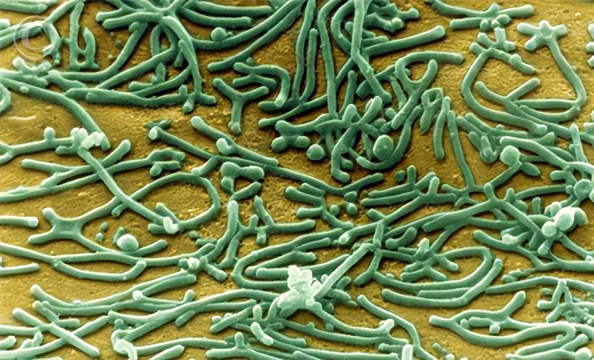 内衣裤穿一天到底有多脏,穿一天的裤子后边有异味