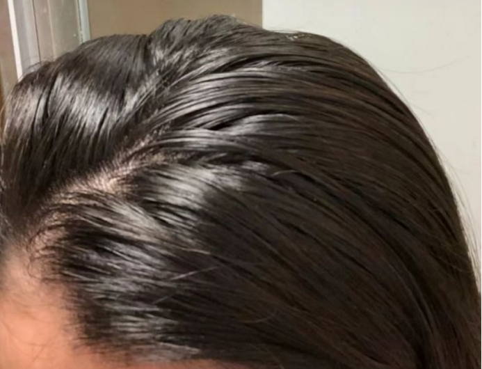 孕妇控油止痒去屑洗发水推荐,控油好的孕妇洗发水品牌