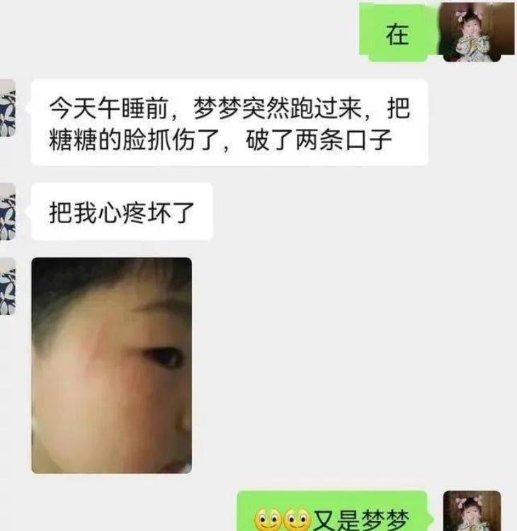 孙女被同学抓破脸，对方家长想拿钱了事，爷爷教科书式回击引夸赞