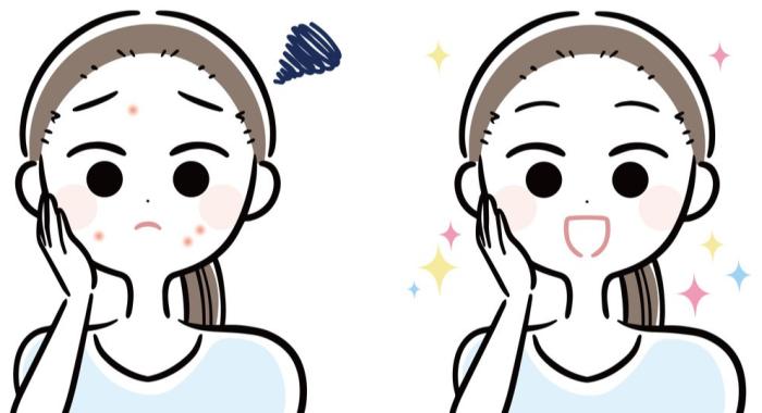 杜莎之谜小黑瓶祛痘,杜莎之谜治痘的优势