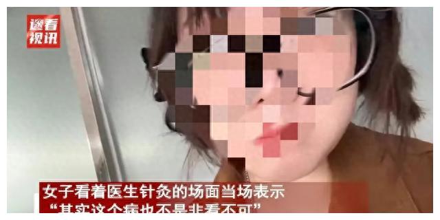 针灸神医爆红网络:天津女子见证奇效,网友赞叹不已!