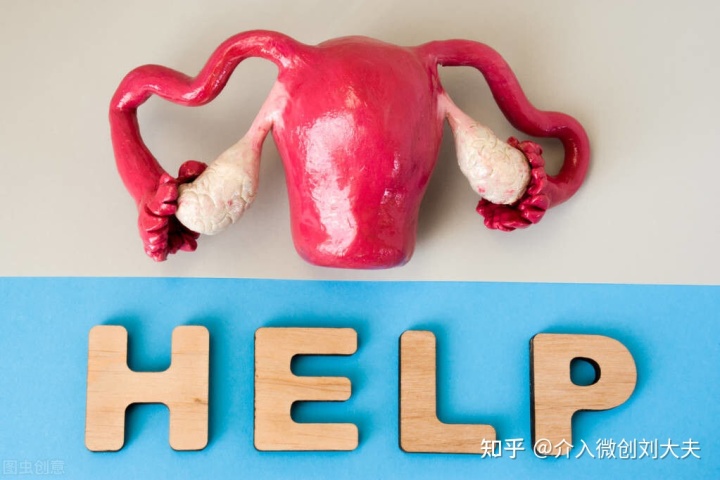 CT引导下介入硬化治疗卵巢巧克力囊肿临床研究招募