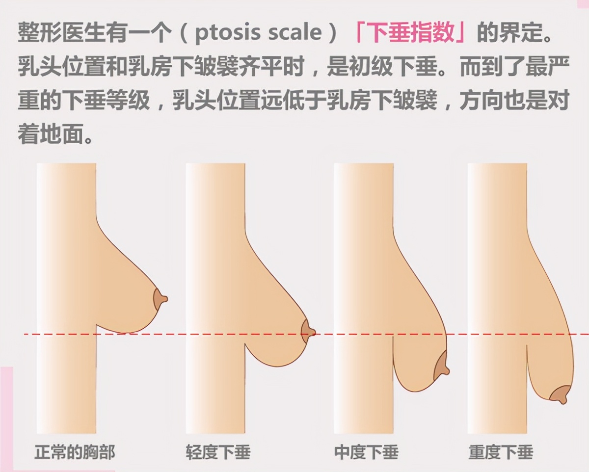 杨幂这身材绝了,这些胸部相关的小知识你一定要知道