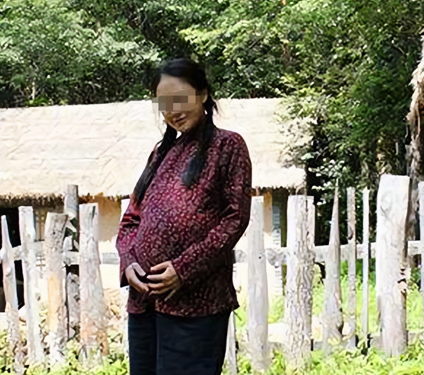 男子喝酒脖子成河马,喝酒喝成河马脖子病