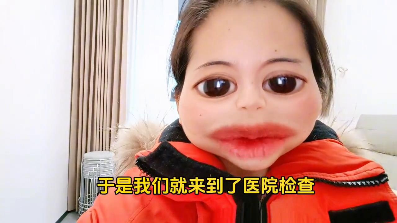 女性手脚皮肤发黄怎么调理,手脚发黄是什么原因引起的女人