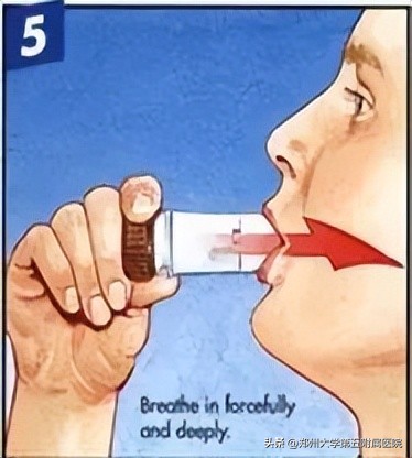 慢阻肺吸入方法您知道吗？