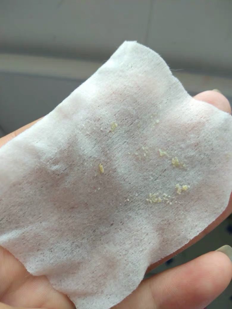 鼻子毛孔小黑头出不来怎么办,小女孩鼻子有黑头毛孔粗怎么办