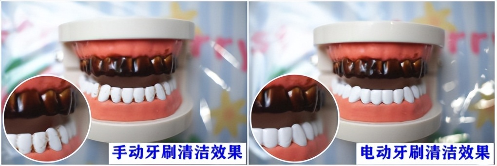 儿童电动牙刷扉乐飞利浦测评,欧乐b和飞利浦电动牙刷评测