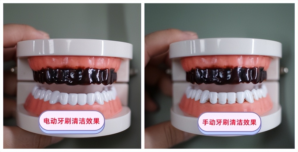 小孩用大人的牙刷对牙齿好吗,最好看的儿童牙刷不会伤牙