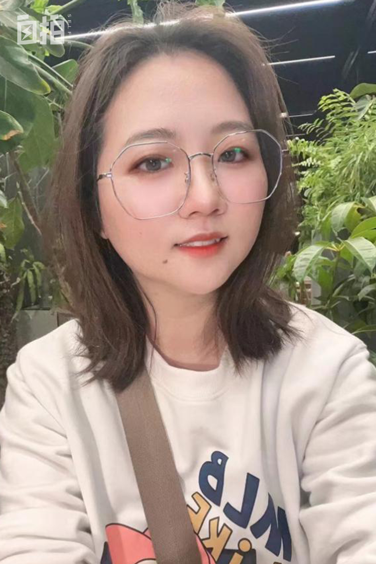 鍏堝ぉ鎬уけ鑱墜鏈垂澶氬皯,澶辫仾鎵嬫湳鎭㈠鍚姏