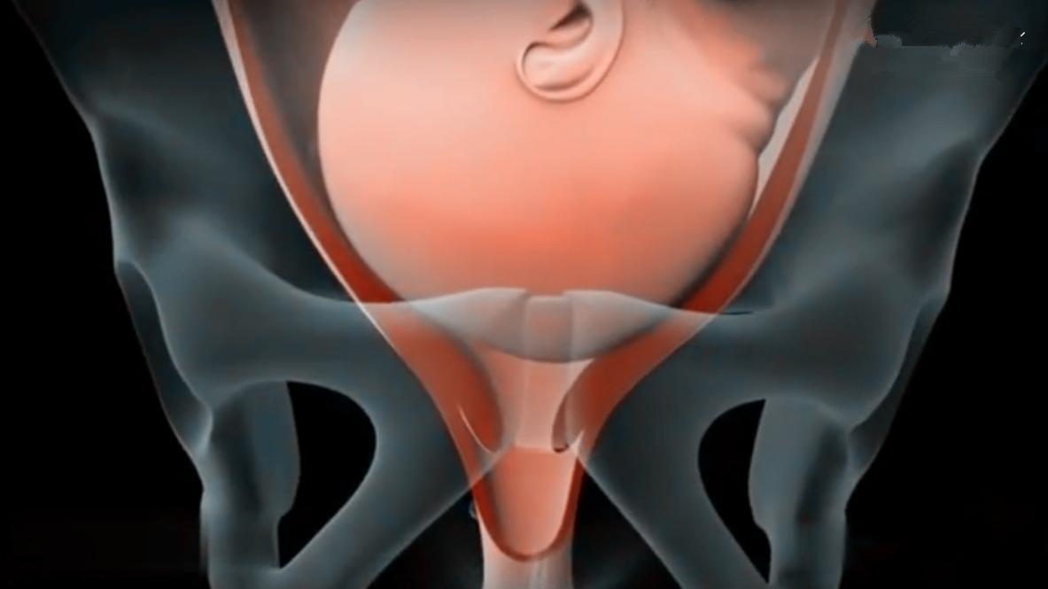 顺产和剖腹产哪个好一些孕妈感受,顺产和剖腹产哪个比较疼