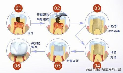 小孩牙齿边缘有黑线要怎么补救,牙齿长黑的东西怎么处理