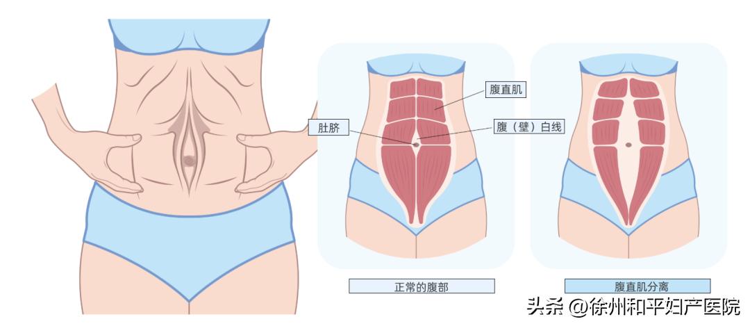 怀孕肚皮撑开的过程,怀孕生娃会长个子吗