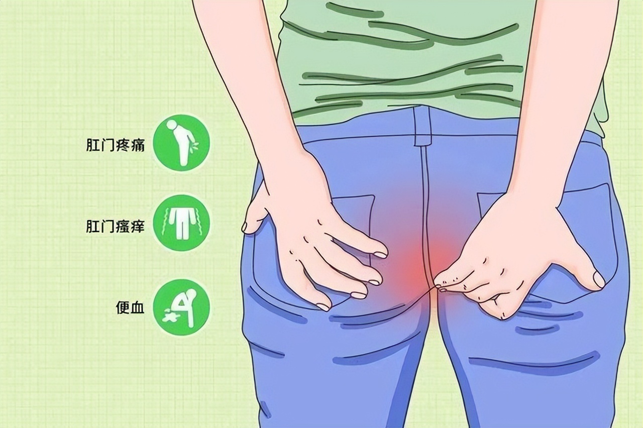 你有洗屁屁的习惯吗,你有洗屁股的习惯吗