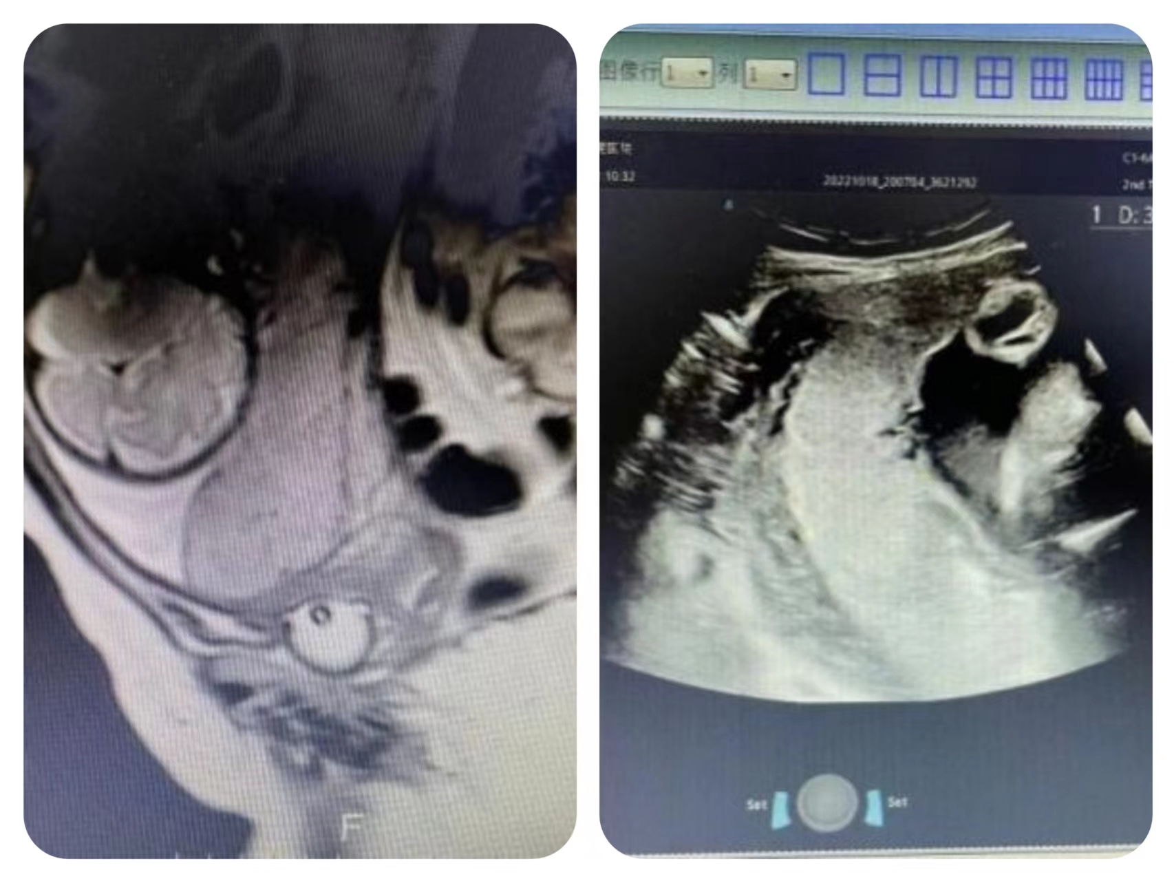 防控疫情我们在一起致敬逆行者,疫情之下我们拼尽全力