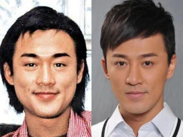 老演员整容脸变形,老年人整容前后照片