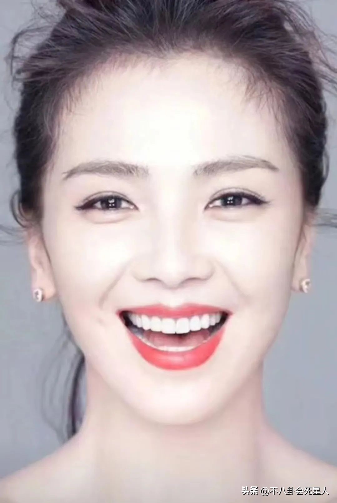 烤瓷牙有多恐怖,烤瓷牙害我一生