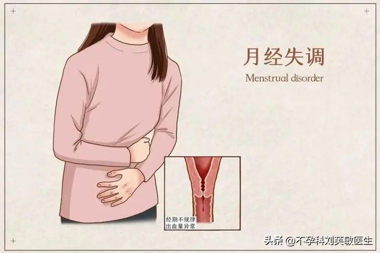 月经有血块跟痛经有关系吗,月经推迟痛经