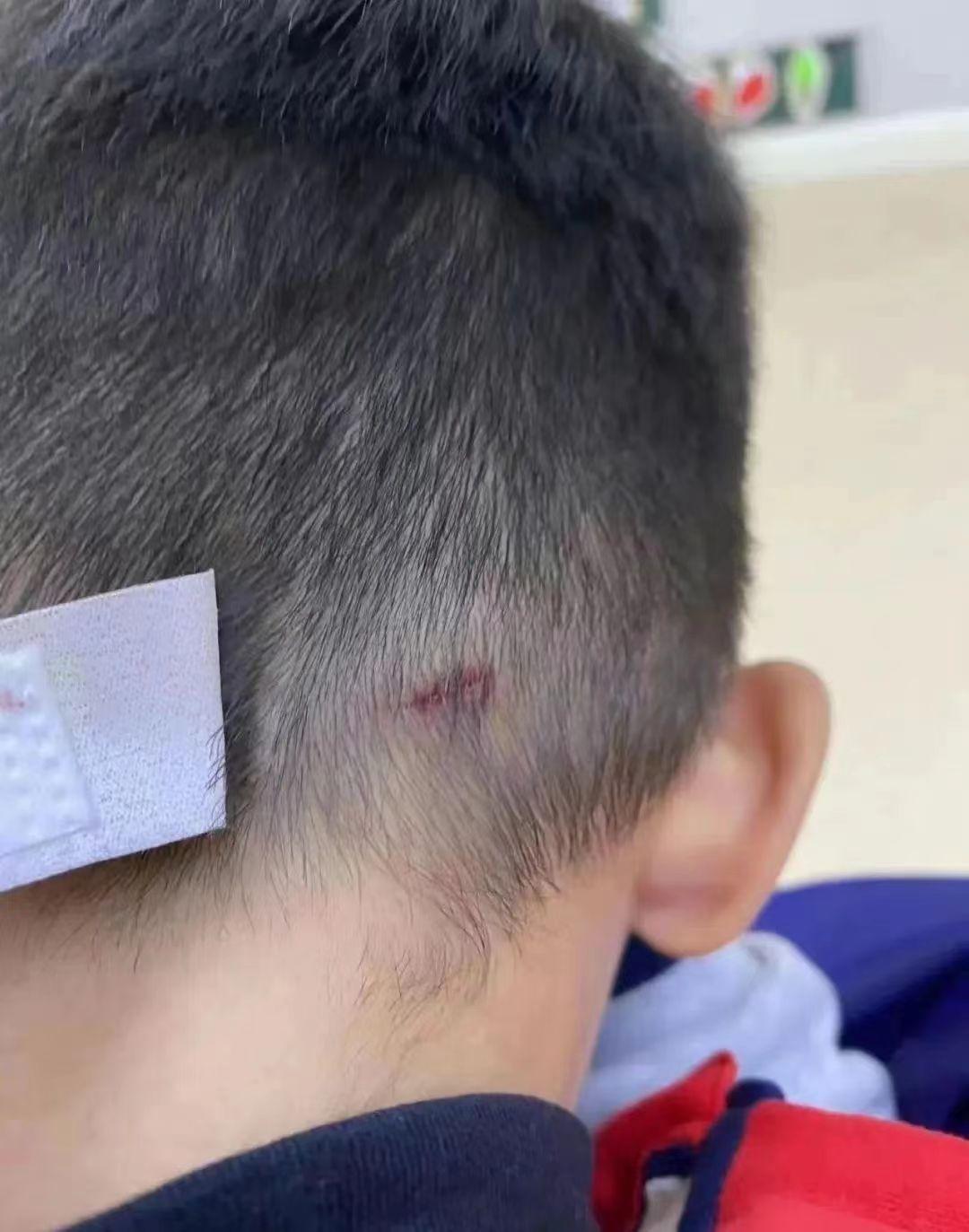 南京上门打人事件最新结果,南京上门打人事件官方公告