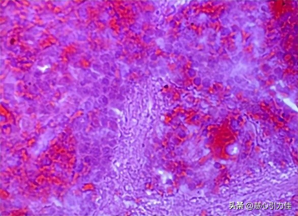 制样方法对IF钢透射电镜复型样品分析,样品的表面光洁度有何变化