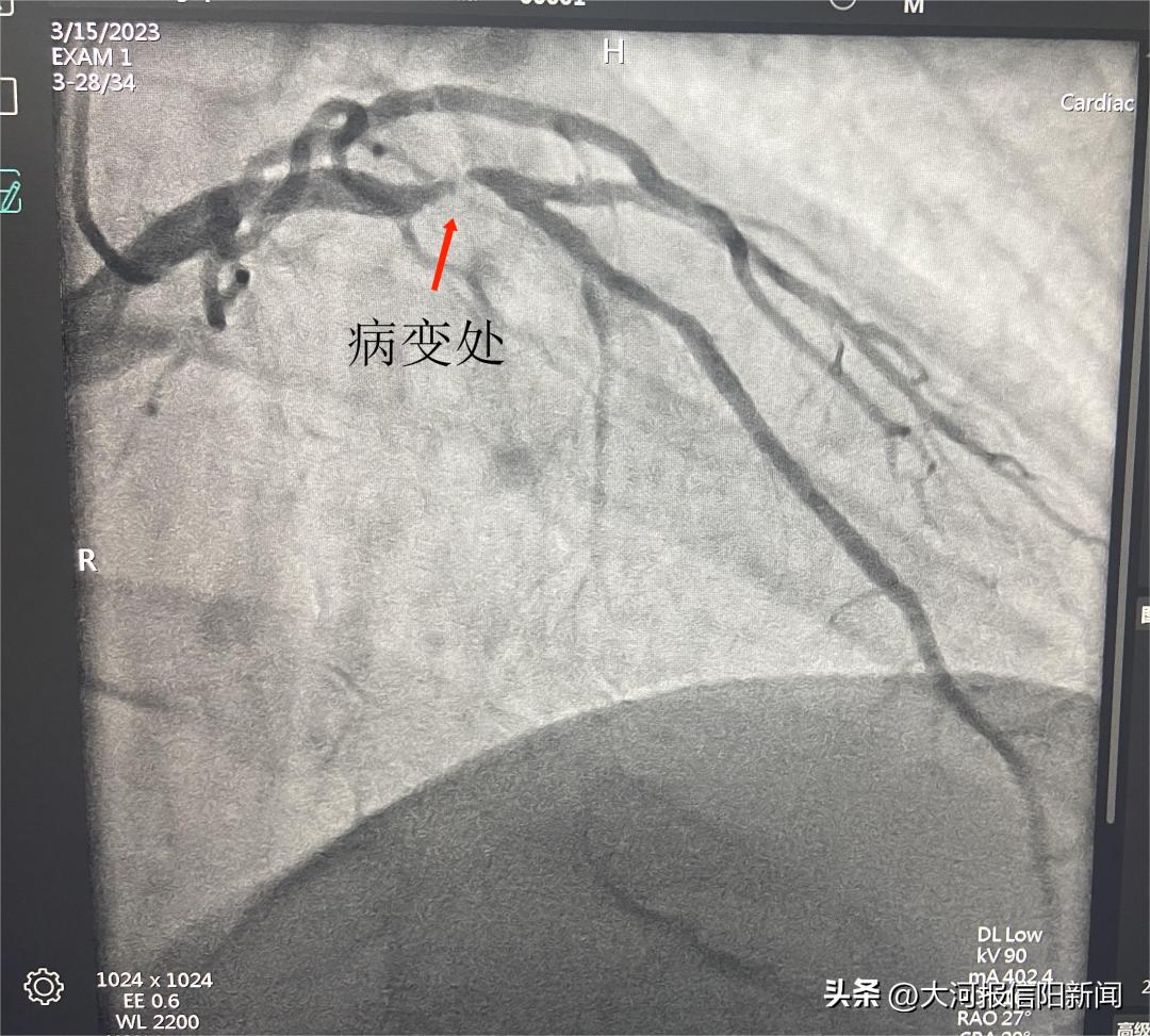 信阳医院手术室及病房净化,信阳中心医院手术室