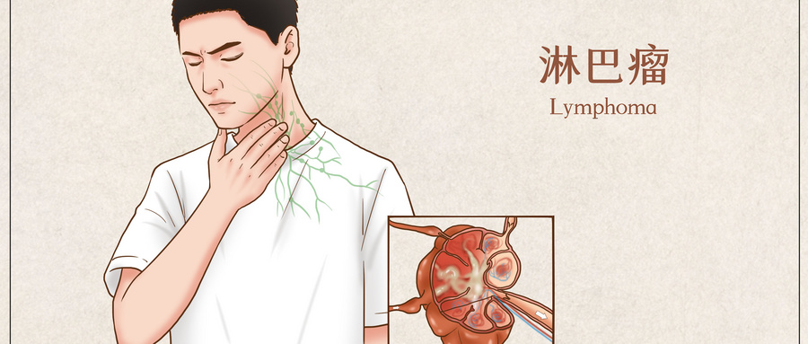 环磷酰胺注射一次副作用多久消除,环磷酰胺治疗轻微病变