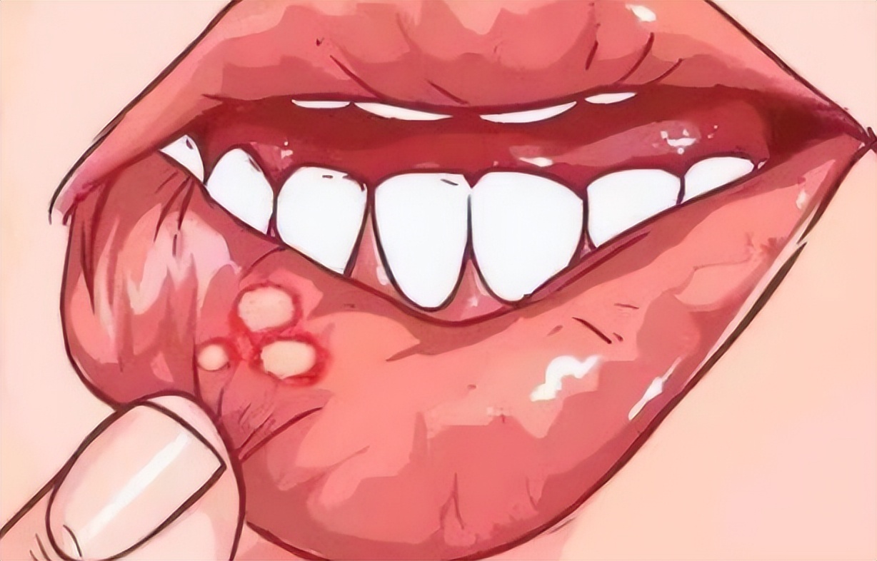 几块钱100片的维生素b12治什么病,几块钱一瓶的维生素b12效果怎么样