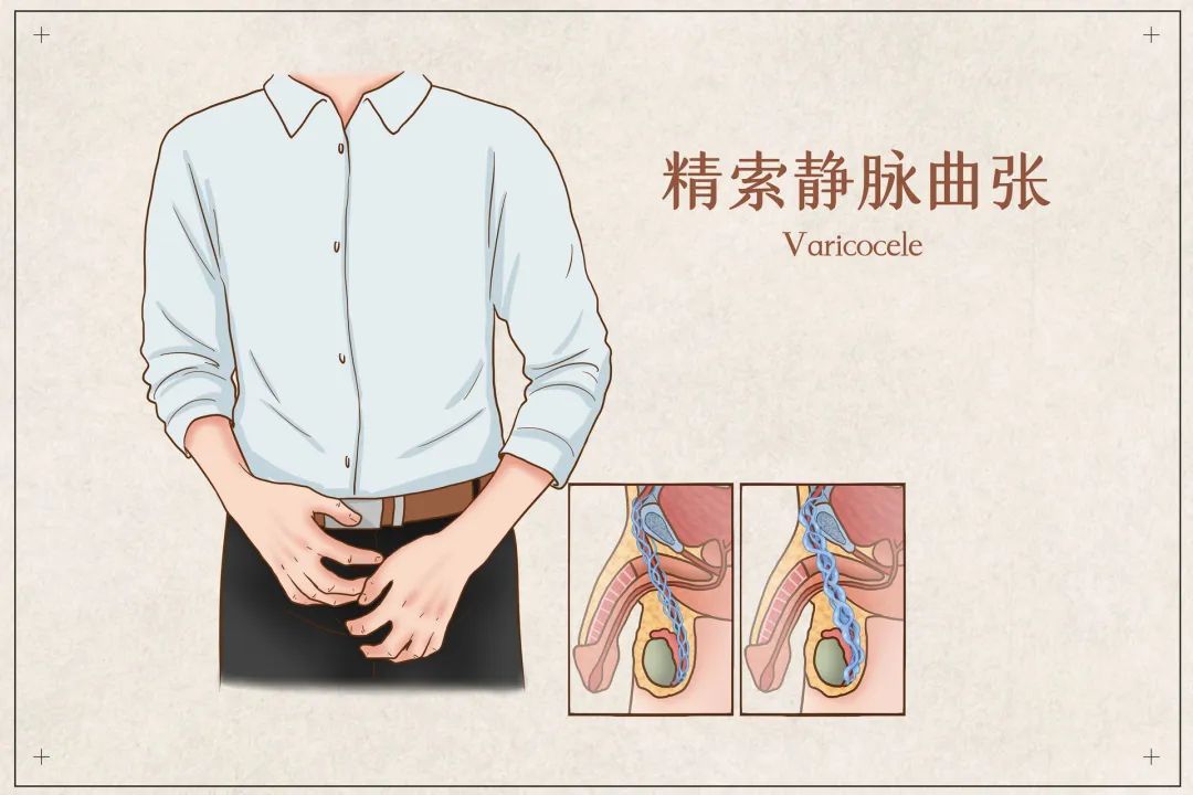 男性一生中最常见的五种疾病，你“中枪”了吗？